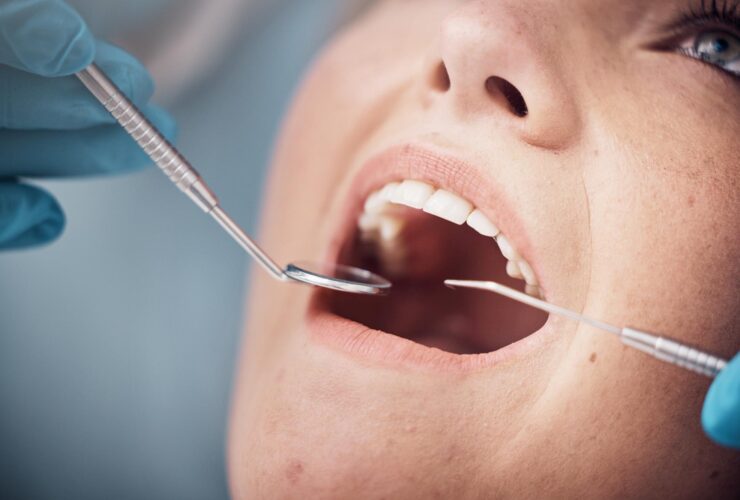 Olykor a gyökércsúcs rezekció jelentheti a megoldást a saját fog megmentésére.